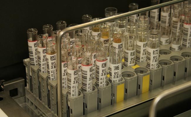 NDTV Urine tests for early cancer detection could also greatly benefit young children who are showing symptoms.